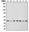 Inhibitor Of Nuclear Factor Kappa B Kinase Regulatory Subunit Gamma antibody, orb214798, Biorbyt, Western Blot image 