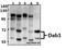 Disabled homolog 1 antibody, A03459, Boster Biological Technology, Western Blot image 