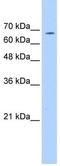 Glycoprotein Ib Platelet Subunit Alpha antibody, ab104704, Abcam, Western Blot image 