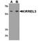 Kirre Like Nephrin Family Adhesion Molecule 3 antibody, TA349103, Origene, Western Blot image 