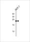 O-6-Methylguanine-DNA Methyltransferase antibody, LS-C204032, Lifespan Biosciences, Western Blot image 