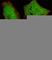 Ubiquilin 1 antibody, F40118-0.4ML, NSJ Bioreagents, Immunohistochemistry paraffin image 