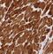 NADH:Ubiquinone Oxidoreductase Subunit C1 antibody, FNab05627, FineTest, Immunohistochemistry paraffin image 