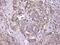 Beta-2-Microglobulin antibody, M00456-2, Boster Biological Technology, Immunohistochemistry frozen image 