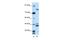 Zinc Finger Protein 607 antibody, A15857, Boster Biological Technology, Western Blot image 