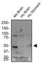Tryptophan Hydroxylase 2 antibody, NB100-74555, Novus Biologicals, Western Blot image 