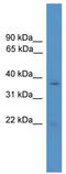 Rhox homeobox family member 1 antibody, TA345505, Origene, Western Blot image 