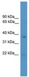 Rhox Homeobox Family Member 1 antibody, TA345505, Origene, Western Blot image 