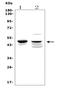 Damage Specific DNA Binding Protein 2 antibody, A01430-2, Boster Biological Technology, Western Blot image 