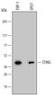 Transmembrane Protein 173 antibody, MAB7169, R&D Systems, Western Blot image 