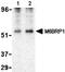 Perilipin 3 antibody, ab47639, Abcam, Western Blot image 