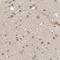 Dynein Light Chain Tctex-Type 3 antibody, PA5-52030, Invitrogen Antibodies, Immunohistochemistry paraffin image 