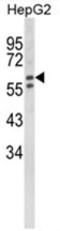 Hexosaminidase Subunit Alpha antibody, AP18045PU-N, Origene, Western Blot image 