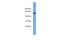 Serum Amyloid A Like 1 antibody, A16266, Boster Biological Technology, Western Blot image 