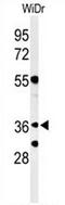 NSE4 Homolog A, SMC5-SMC6 Complex Component antibody, AP52941PU-N, Origene, Western Blot image 