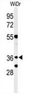 NSE4 Homolog A, SMC5-SMC6 Complex Component antibody, AP52941PU-N, Origene, Western Blot image 