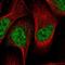 Casein Kinase 1 Gamma 3 antibody, NBP1-91045, Novus Biologicals, Immunocytochemistry image 