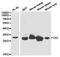 Carbonic Anhydrase 2 antibody, LS-B12922, Lifespan Biosciences, Western Blot image 