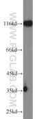 Huntingtin Interacting Protein 1 antibody, 22231-1-AP, Proteintech Group, Western Blot image 