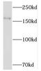 NK-tumor recognition protein antibody, FNab05748, FineTest, Western Blot image 