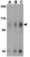 Glutamate Ionotropic Receptor Kainate Type Subunit 2 antibody, GTX31328, GeneTex, Western Blot image 