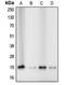 Cofilin 1 antibody, MBS821757, MyBioSource, Western Blot image 