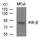 Inhibitor Of Nuclear Factor Kappa B Kinase Subunit Beta antibody, 79-613, ProSci, Western Blot image 