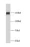 Damage Specific DNA Binding Protein 1 antibody, FNab02284, FineTest, Western Blot image 