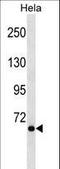 Nuclear Receptor Coactivator 4 antibody, LS-C164778, Lifespan Biosciences, Western Blot image 