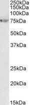 Myosin Heavy Chain 9 antibody, 43-565, ProSci, Western Blot image 