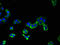 AP2 Associated Kinase 1 antibody, LS-C500941, Lifespan Biosciences, Immunofluorescence image 