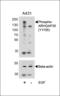 Rho GTPase Activating Protein 35 antibody, MBS9207595, MyBioSource, Western Blot image 