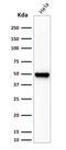 Fascin Actin-Bundling Protein 1 antibody, GTX34717, GeneTex, Western Blot image 