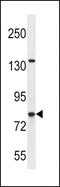 Carnitine Palmitoyltransferase 1C antibody, LS-C167009, Lifespan Biosciences, Western Blot image 