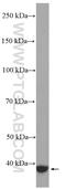 G Protein Subunit Alpha Q antibody, 27264-1-AP, Proteintech Group, Western Blot image 