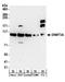 DNA Methyltransferase 3 Alpha antibody, A304-278A, Bethyl Labs, Western Blot image 
