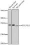 Hydroxysteroid 17-Beta Dehydrogenase 13 antibody, GTX33250, GeneTex, Western Blot image 