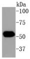Keratin 16 antibody, NBP2-67559, Novus Biologicals, Western Blot image 