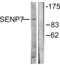 SUMO Specific Peptidase 7 antibody, abx013231, Abbexa, Western Blot image 