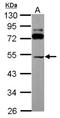 Solute Carrier Family 25 Member 23 antibody, NBP2-20389, Novus Biologicals, Western Blot image 