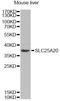 Mitochondrial carnitine/acylcarnitine carrier protein antibody, LS-C748971, Lifespan Biosciences, Western Blot image 