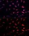Proteasome Subunit Beta 1 antibody, GTX54643, GeneTex, Immunofluorescence image 