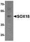 SRY-Box 18 antibody, A04004, Boster Biological Technology, Western Blot image 