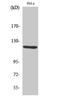 Ro antibody, STJ91608, St John