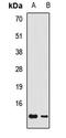 G Protein Subunit Gamma 3 antibody, orb412889, Biorbyt, Western Blot image 