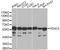 Histone Deacetylase 2 antibody, STJ23929, St John