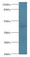 ArfGAP With Dual PH Domains 1 antibody, MBS1492591, MyBioSource, Western Blot image 