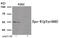 Erythropoietin receptor antibody, 80-044, ProSci, Western Blot image 