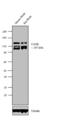 Calcium/Calmodulin Dependent Serine Protein Kinase antibody, PA1-544, Invitrogen Antibodies, Western Blot image 