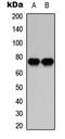 Protein Kinase C Beta antibody, LS-C358253, Lifespan Biosciences, Western Blot image 